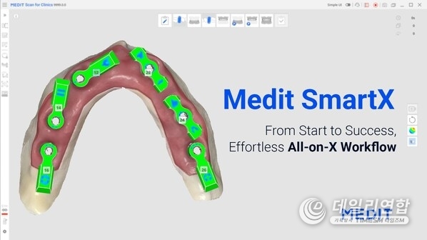 Medit SmartX