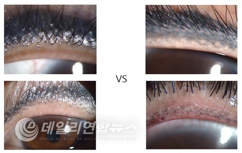 ▲ 사진제공=서울특별시 보라매병원